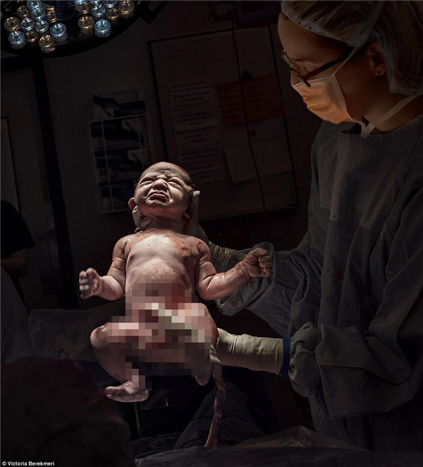摄影师记录新生儿出生瞬间 鼓励母亲不要害怕