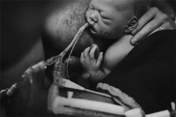 这个宝宝仅有5天的生命 摄影师为他记录短短的人间旅程